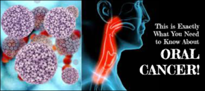 Oral cancer detection