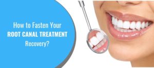 How to Fasten Your Root Canal Treatment Recovery?