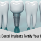 6 Ways Dental Implants Fortify Your Natural Teeth