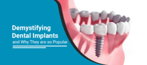 Dental implants in Pimpri Chinchwad