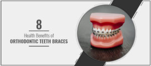 Orthodontist in Pimpri Chinchwad
