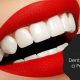 Few Tips by Dentists to Have a Perfect Smile