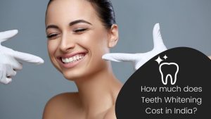 How much does Teeth Whitening Cost in India