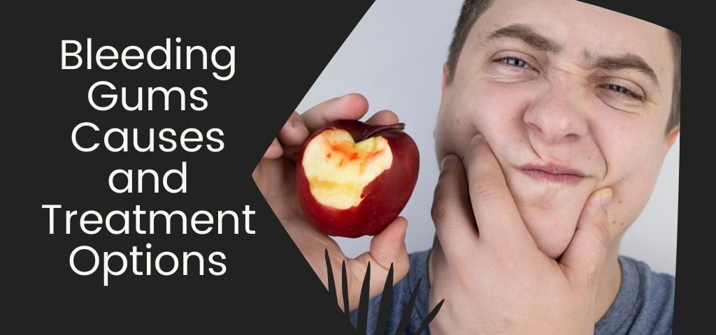 Bleeding Gums Causes and Treatment Options