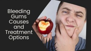 Bleeding Gums Causes and Treatment Options