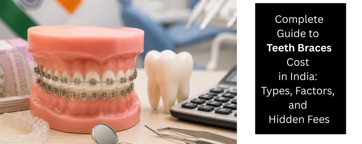 Complete Guide to Teeth Braces Cost in India Types, Factors, and Hidden Fee